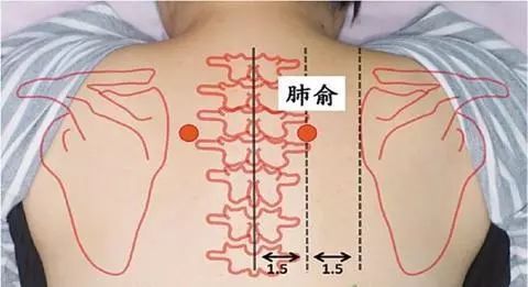 艾灸治疗哮喘要灸这五个穴位