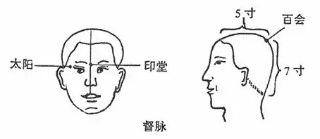 艾灸百会穴