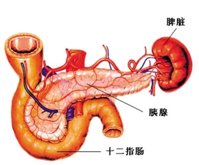 胰腺炎治疗