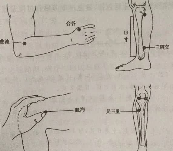 【艾灸取穴】曲池,合谷,血海,足三里,三阴交穴