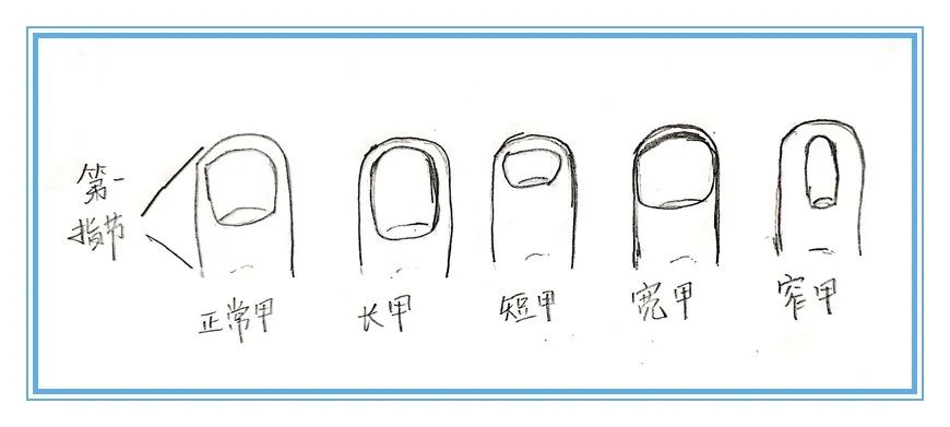 望甲诊病图解,根据指甲的颜色诊病