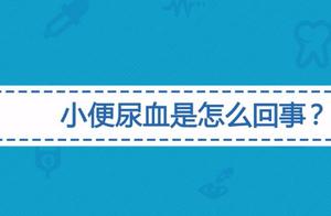 尿血是怎么回事?妊娠尿血艾灸穴位及方法